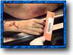 Autopsy pictures #22